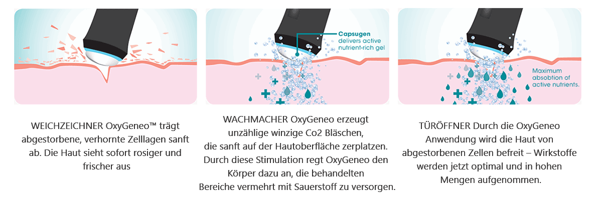 OxyGeneo Aufsatz Wien