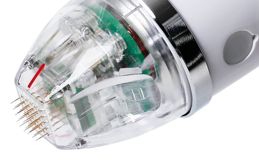 Secret RF Behandlung Wien